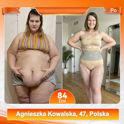 📢 Odkrycie z TikToka – nowość Kkio® 👩 4 w 1 modelujące i wyszczuplające spodenki z technologią mikroigiełek oraz moringą i berberyną ✅ Stworzone z myślą o codziennym komforcie kobiet