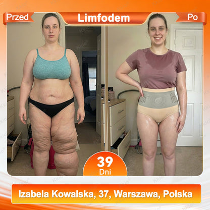 📢 Odkrycie z TikToka – nowość Kkio® 👩 4 w 1 modelujące i wyszczuplające spodenki z technologią mikroigiełek oraz moringą i berberyną ✅ Stworzone z myślą o codziennym komforcie kobiet